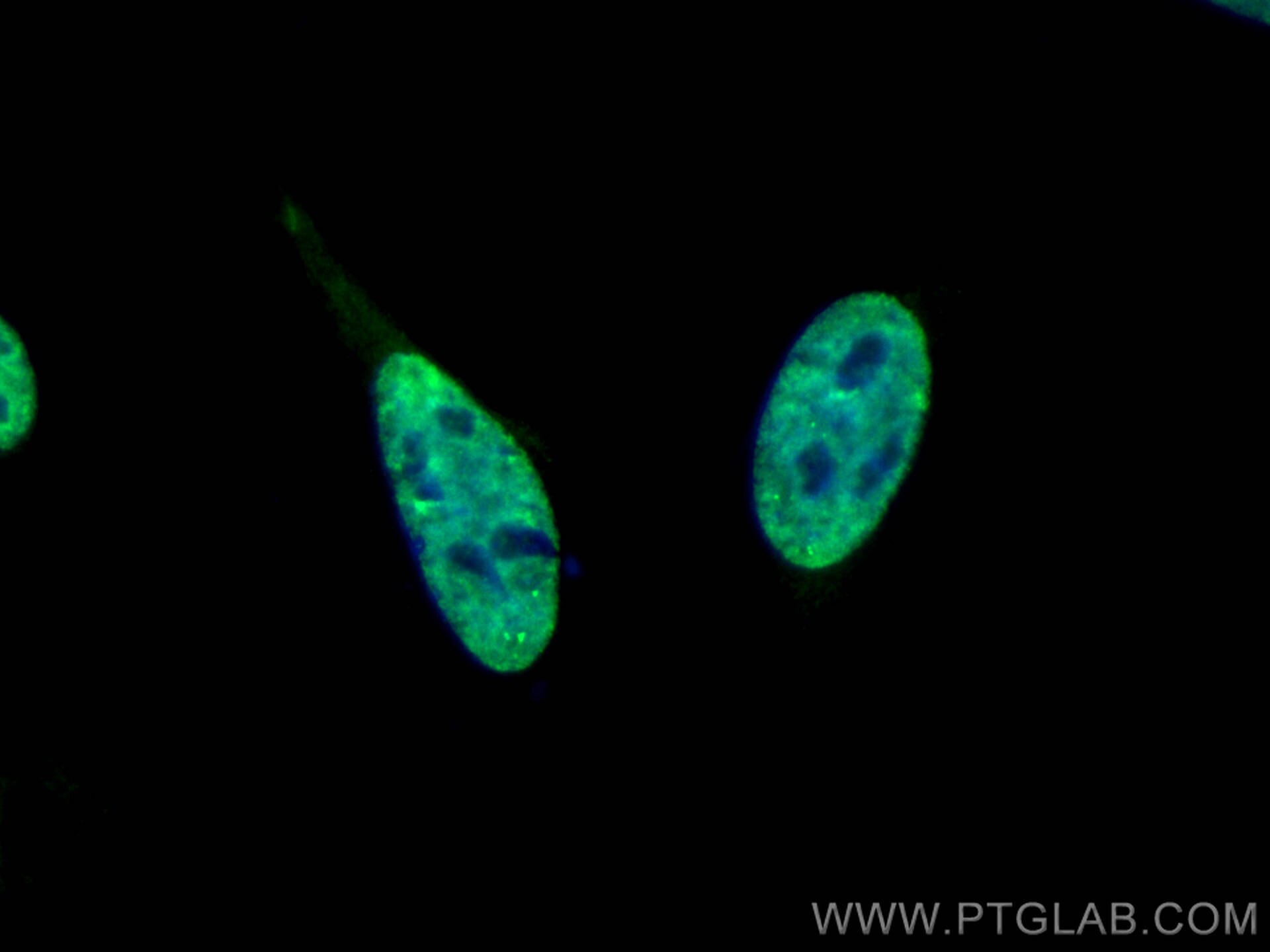 IF Staining of HeLa using CL488-67469