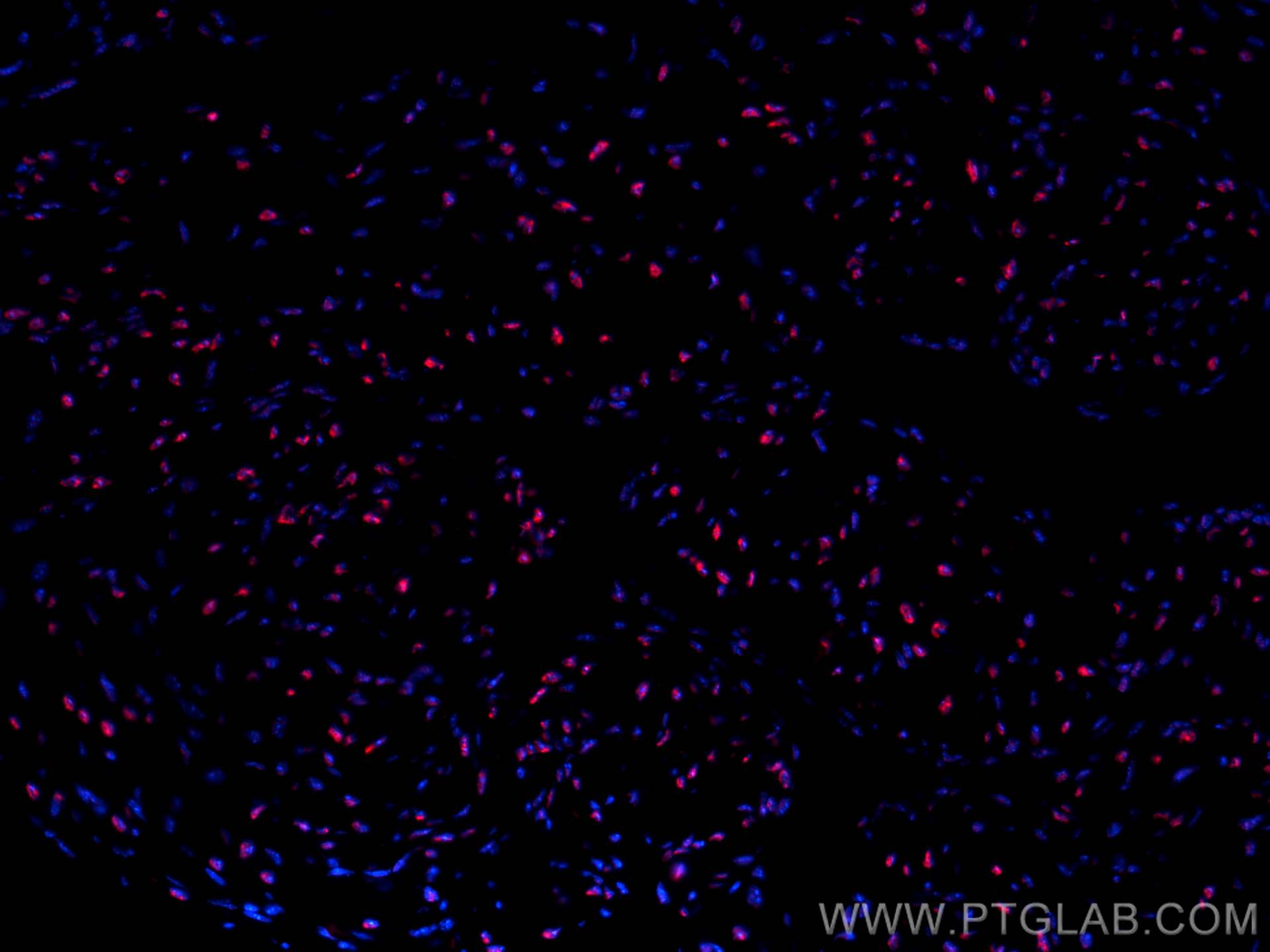 Immunofluorescence (IF) / fluorescent staining of mouse heart tissue using CoraLite®594-conjugated SF3B3 Polyclonal antibody (CL594-14577)