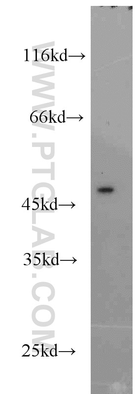 Western Blot (WB) analysis of HEK-293 cells using SF3B4 Polyclonal antibody (10482-1-AP)
