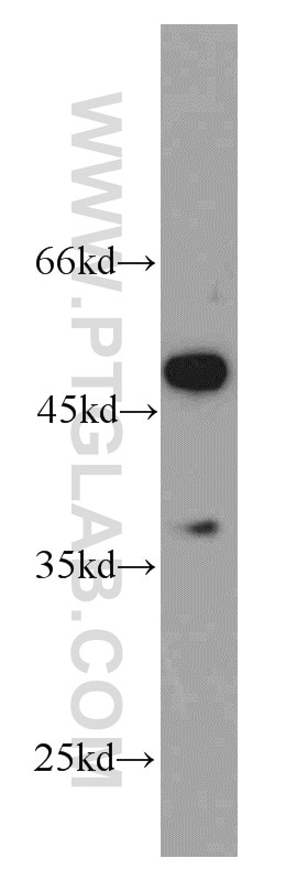 Western Blot (WB) analysis of PC-3 cells using SF3B4 Polyclonal antibody (10482-1-AP)