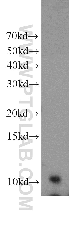 Western Blot (WB) analysis of HeLa cells using SF3B5 Polyclonal antibody (15525-1-AP)