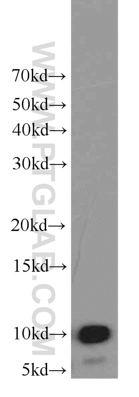 WB analysis of SH-SY5Y using 15525-1-AP