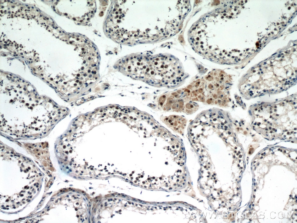 Immunohistochemistry (IHC) staining of human testis tissue using SF4 Polyclonal antibody (15614-1-AP)