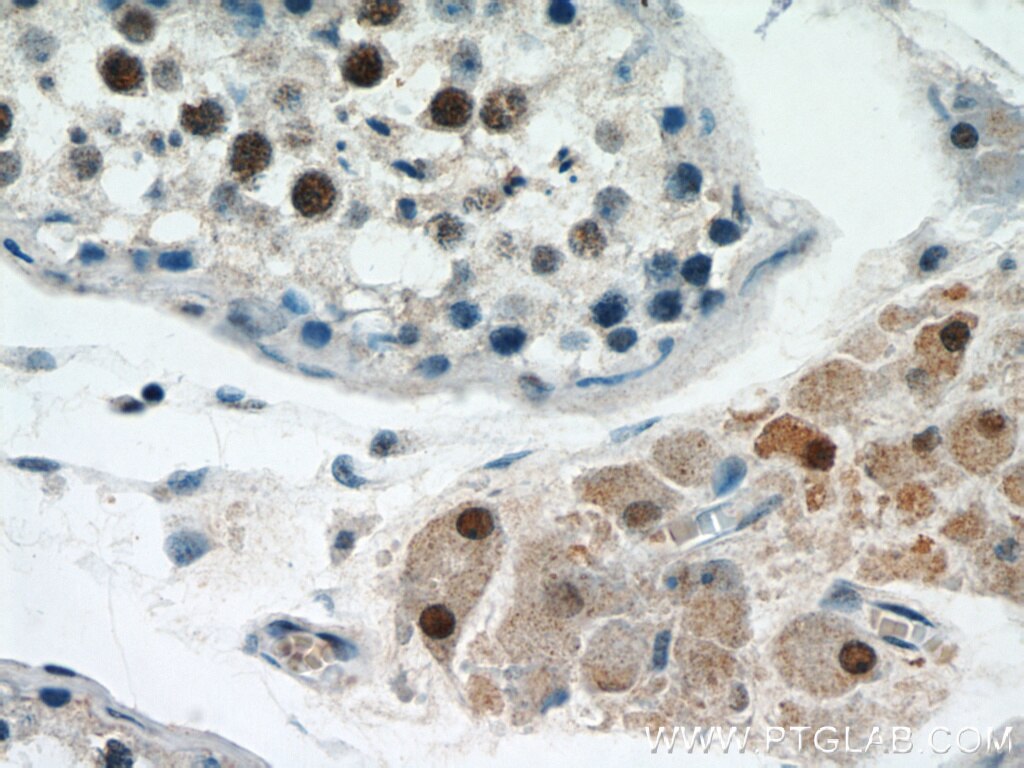 Immunohistochemistry (IHC) staining of human testis tissue using SF4 Polyclonal antibody (15614-1-AP)