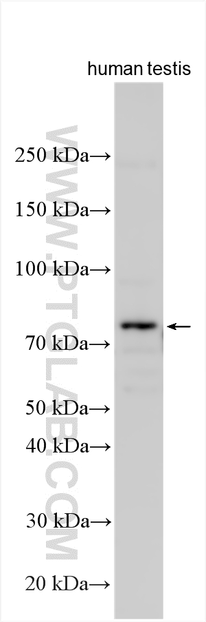 Western Blot (WB) analysis of various lysates using SF4 Polyclonal antibody (15614-1-AP)
