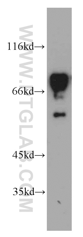 Western Blot (WB) analysis of HEK-293 cells using SF4 Polyclonal antibody (15614-1-AP)