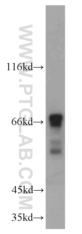 Western Blot (WB) analysis of mouse testis tissue using SF4 Polyclonal antibody (15614-1-AP)