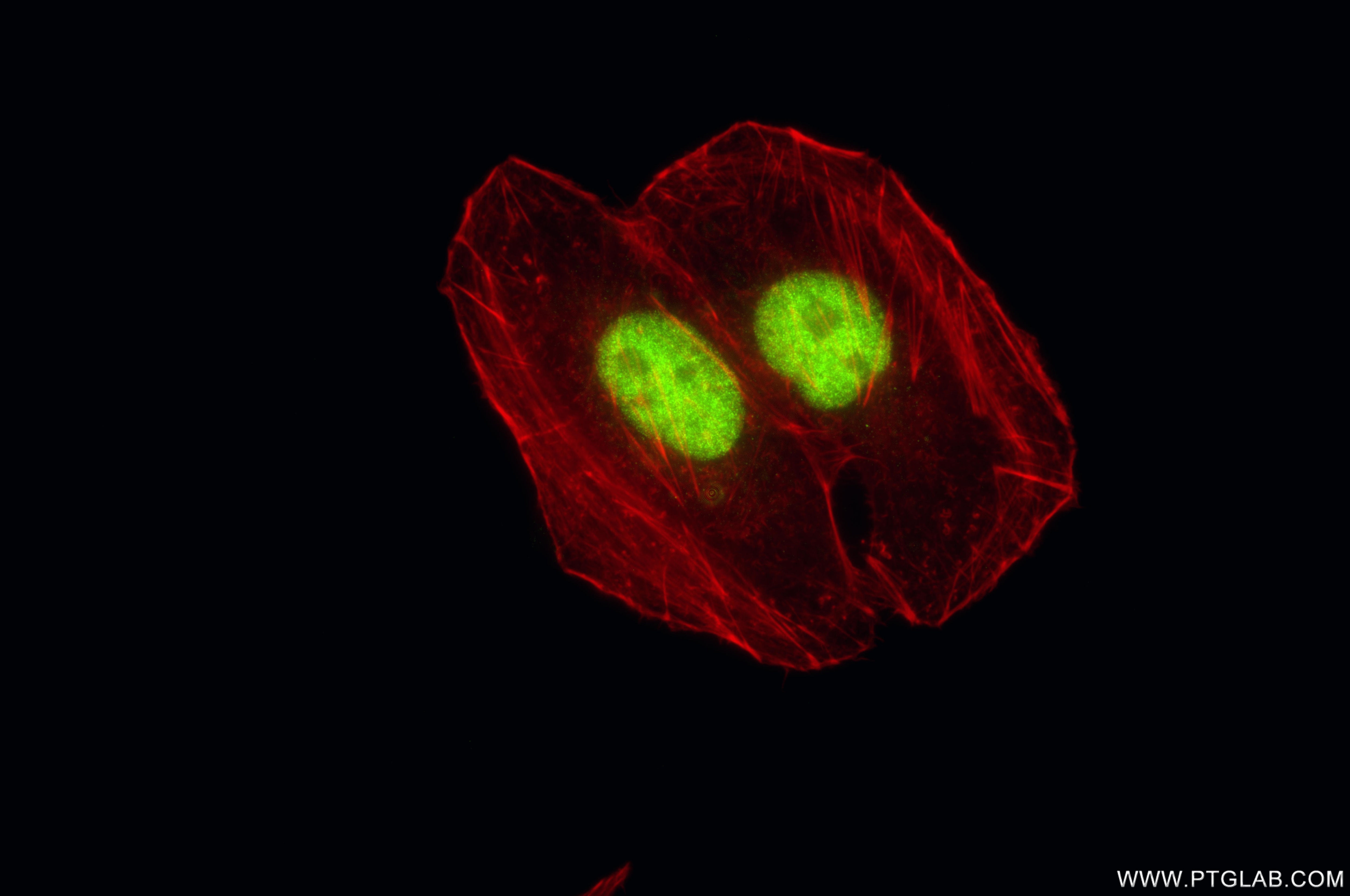 Immunofluorescence (IF) / fluorescent staining of HepG2 cells using SF4 Recombinant monoclonal antibody (87600-1-RR)
