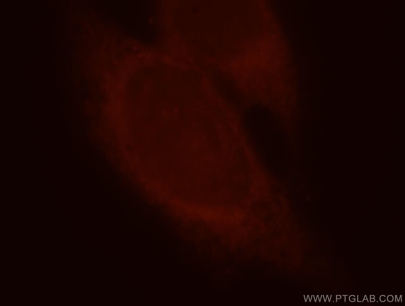 Immunofluorescence (IF) / fluorescent staining of HeLa cells using SFI1 Polyclonal antibody (13550-1-AP)