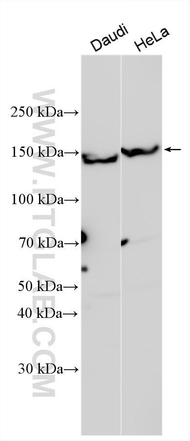 Western Blot (WB) analysis of various lysates using SFI1 Polyclonal antibody (13550-1-AP)