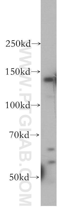 Western Blot (WB) analysis of HepG2 cells using SFI1 Polyclonal antibody (13550-1-AP)