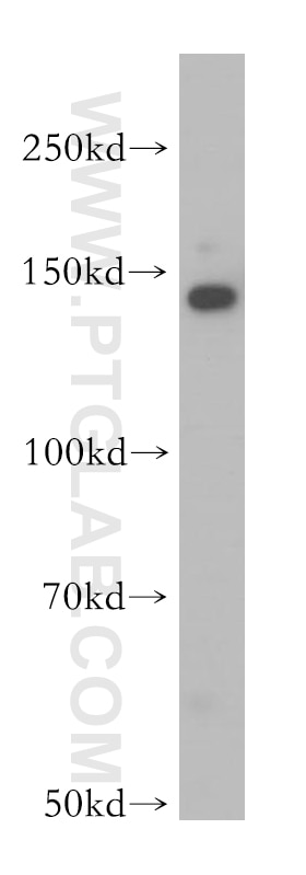 Western Blot (WB) analysis of A549 cells using SFI1 Polyclonal antibody (13550-1-AP)