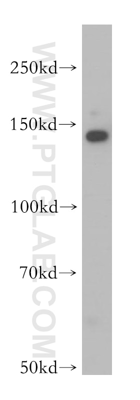 WB analysis of A549 using 13550-1-AP