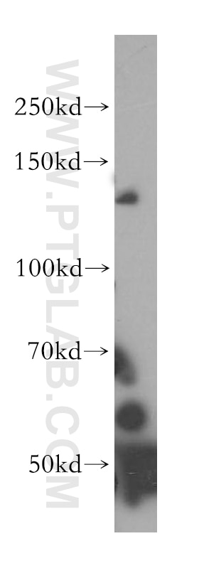 Western Blot (WB) analysis of mouse lung tissue using SFI1 Polyclonal antibody (13550-1-AP)