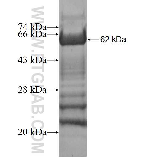 SFI1 fusion protein Ag4268 SDS-PAGE