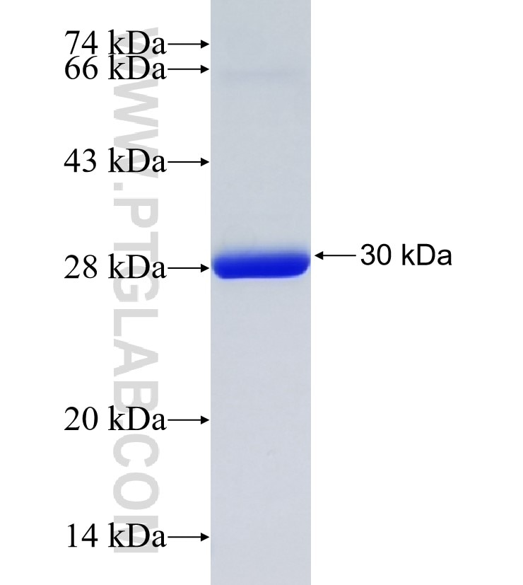 SFMBT1 fusion protein Ag20417 SDS-PAGE