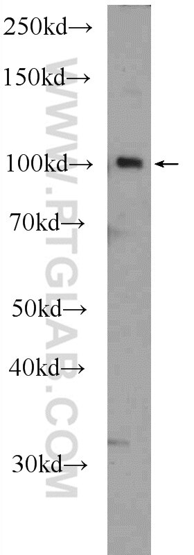 Western Blot (WB) analysis of NIH/3T3 cells using SFMBT2 Polyclonal antibody (25256-1-AP)