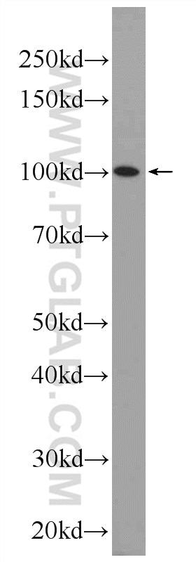 Western Blot (WB) analysis of mouse spleen tissue using SFMBT2 Polyclonal antibody (25256-1-AP)