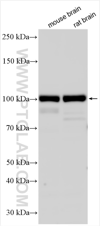 Western Blot (WB) analysis of various lysates using SFMBT2 Polyclonal antibody (25256-1-AP)