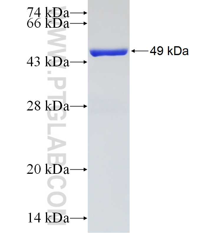 SFMBT2 fusion protein Ag19353 SDS-PAGE