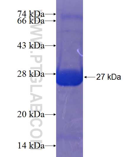 SFMBT2 fusion protein Ag19379 SDS-PAGE