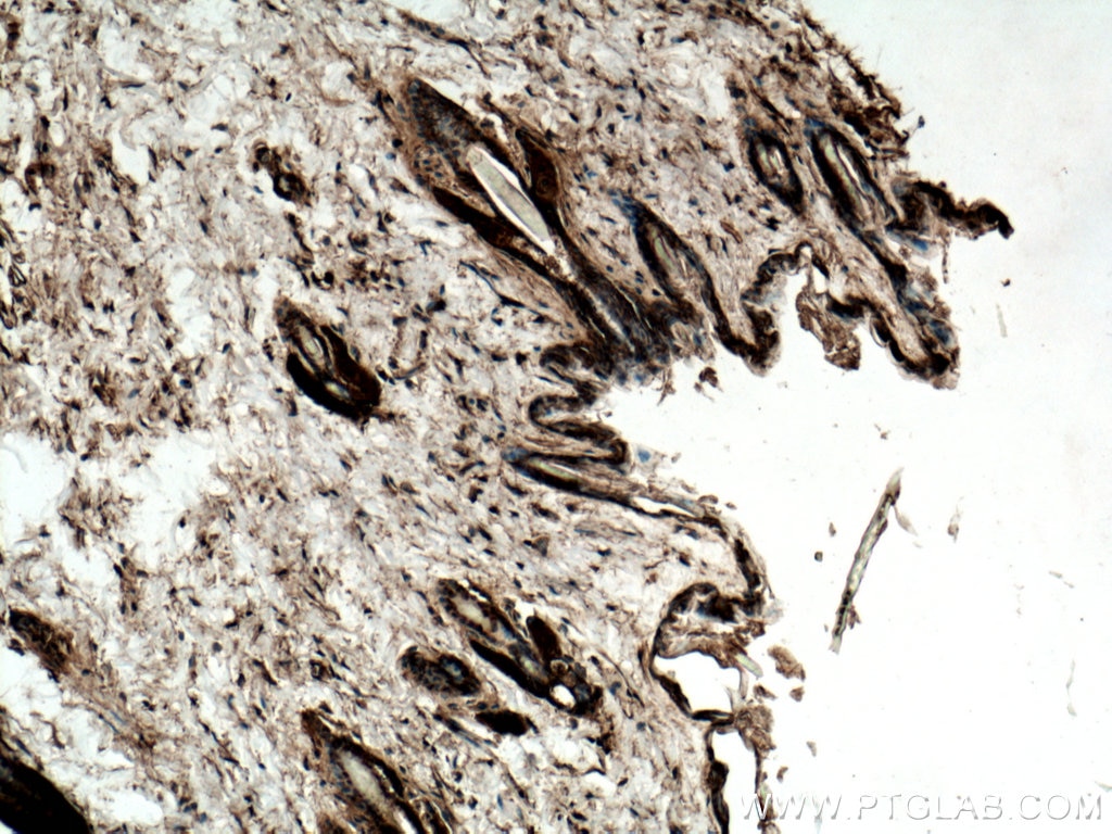 Immunohistochemistry (IHC) staining of mouse skin tissue using 14-3-3 Sigma Polyclonal antibody (10622-1-AP)