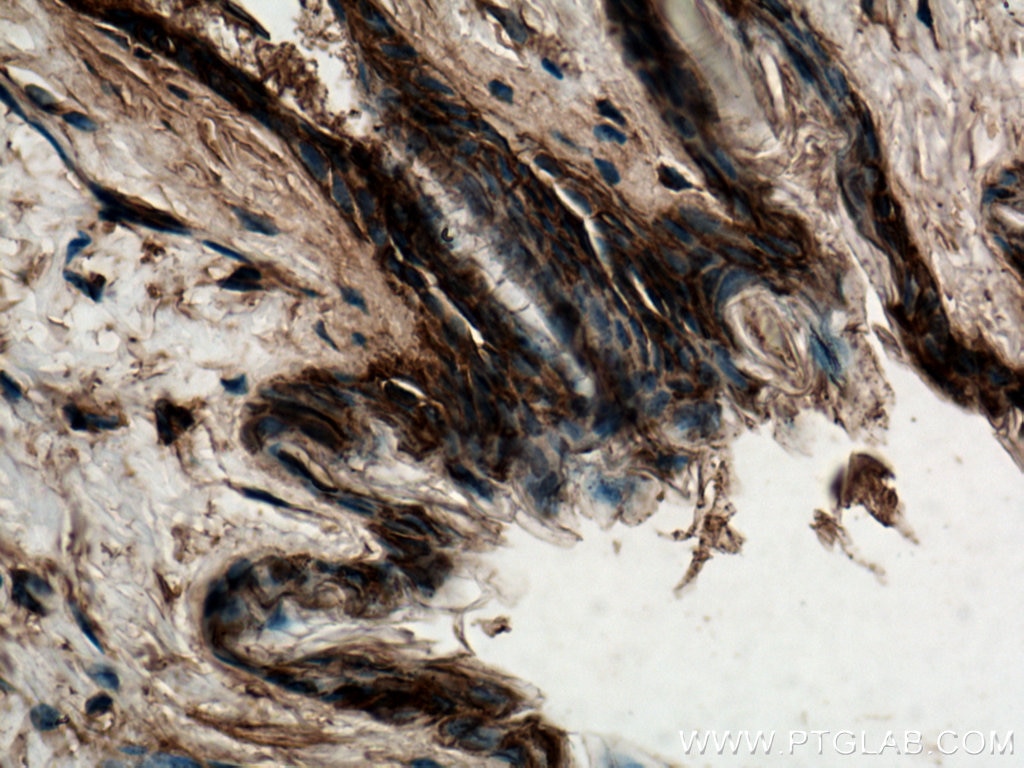 Immunohistochemistry (IHC) staining of mouse skin tissue using 14-3-3 Sigma Polyclonal antibody (10622-1-AP)