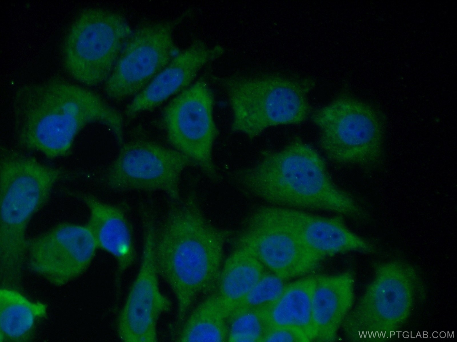 IF Staining of MCF-7 using 66251-1-Ig