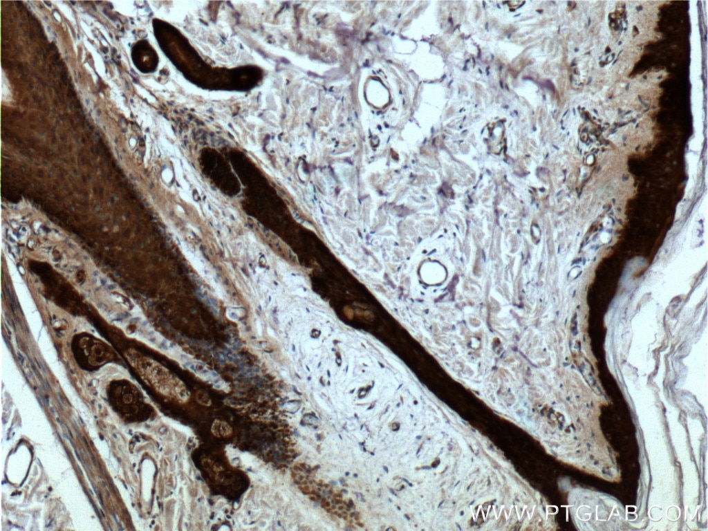 Immunohistochemistry (IHC) staining of human skin tissue using 14-3-3 Sigma Monoclonal antibody (66251-1-Ig)