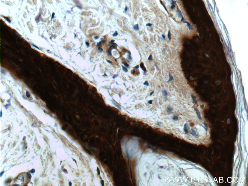 Immunohistochemistry (IHC) staining of human skin tissue using 14-3-3 Sigma Monoclonal antibody (66251-1-Ig)