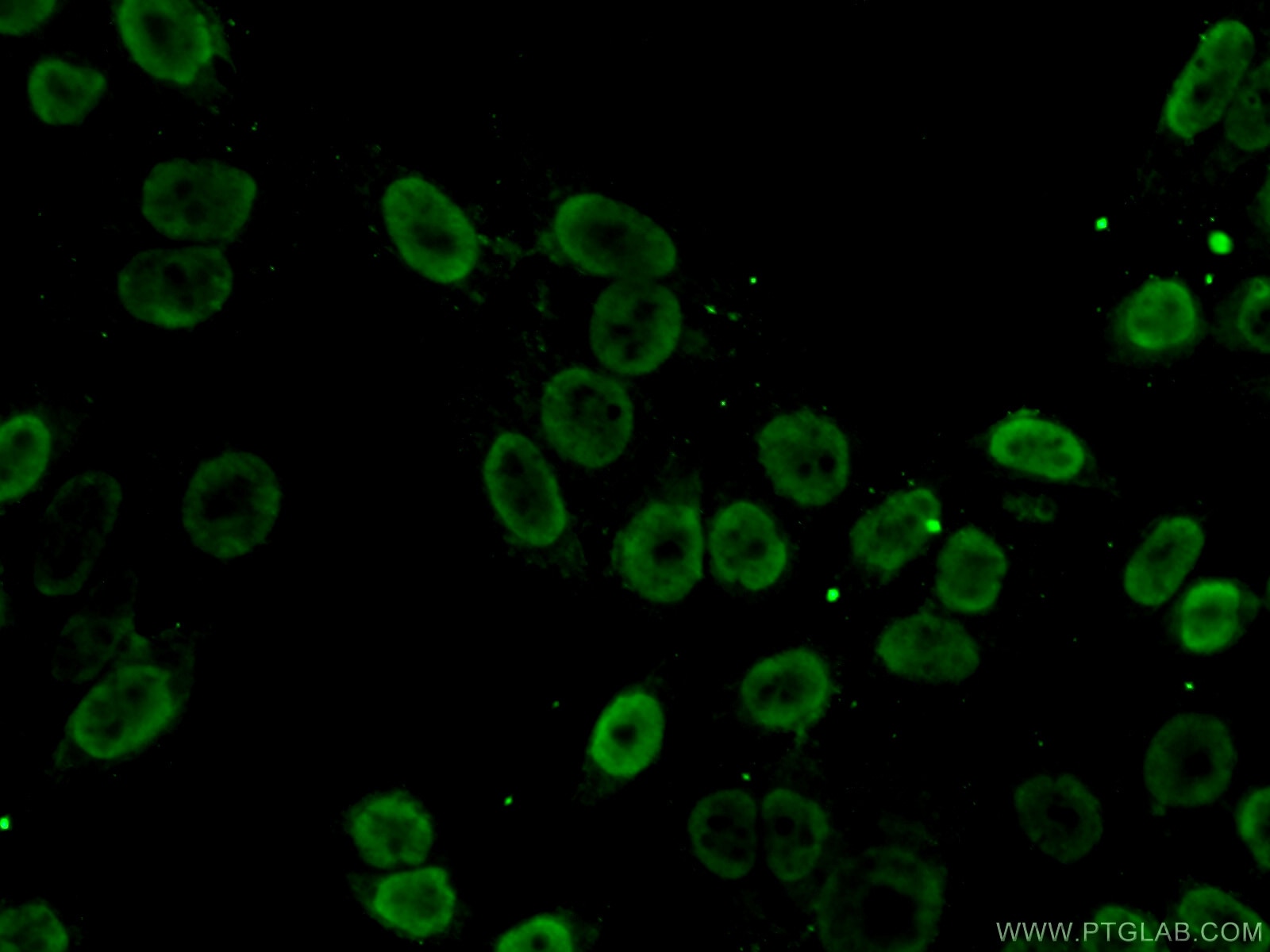 Immunofluorescence (IF) / fluorescent staining of HeLa cells using SFPQ Polyclonal antibody (15585-1-AP)