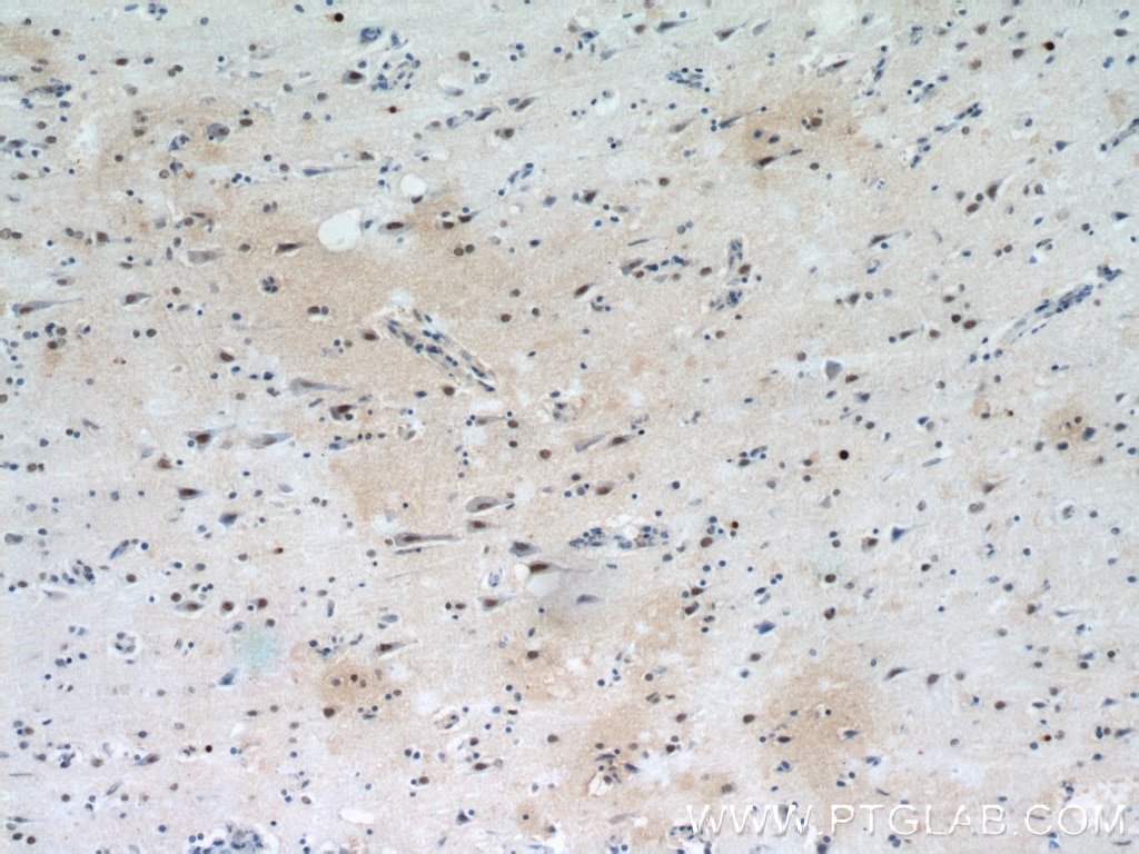 Immunohistochemistry (IHC) staining of human brain tissue using SFPQ Polyclonal antibody (15585-1-AP)