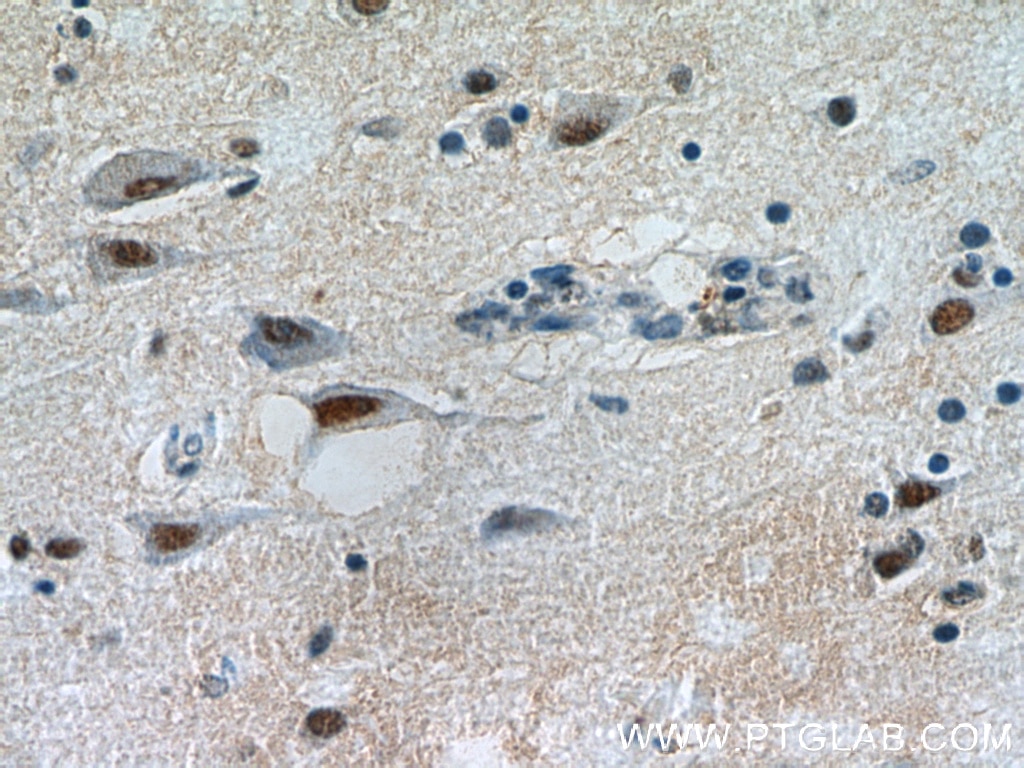 Immunohistochemistry (IHC) staining of human brain tissue using SFPQ Polyclonal antibody (15585-1-AP)