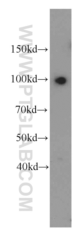 SFPQ Polyclonal antibody