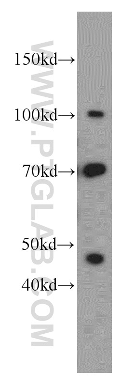 Western Blot (WB) analysis of Jurkat cells using SFPQ Polyclonal antibody (15585-1-AP)