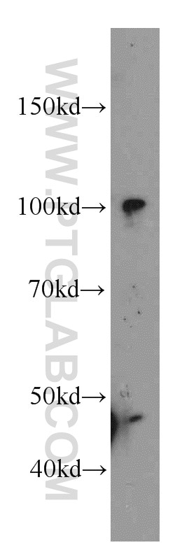 WB analysis of Y79 using 15585-1-AP