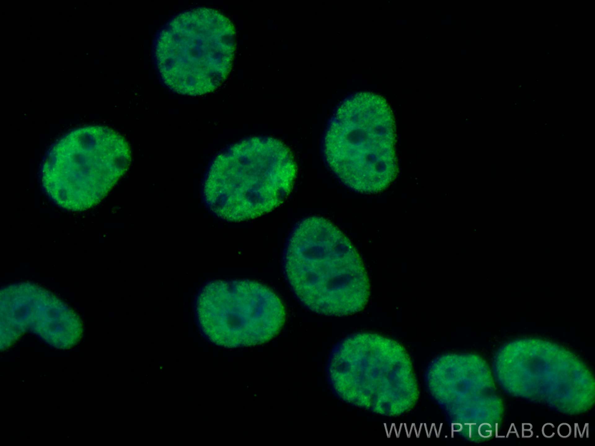 Immunofluorescence (IF) / fluorescent staining of MCF-7 cells using SFPQ Monoclonal antibody (67129-1-Ig)