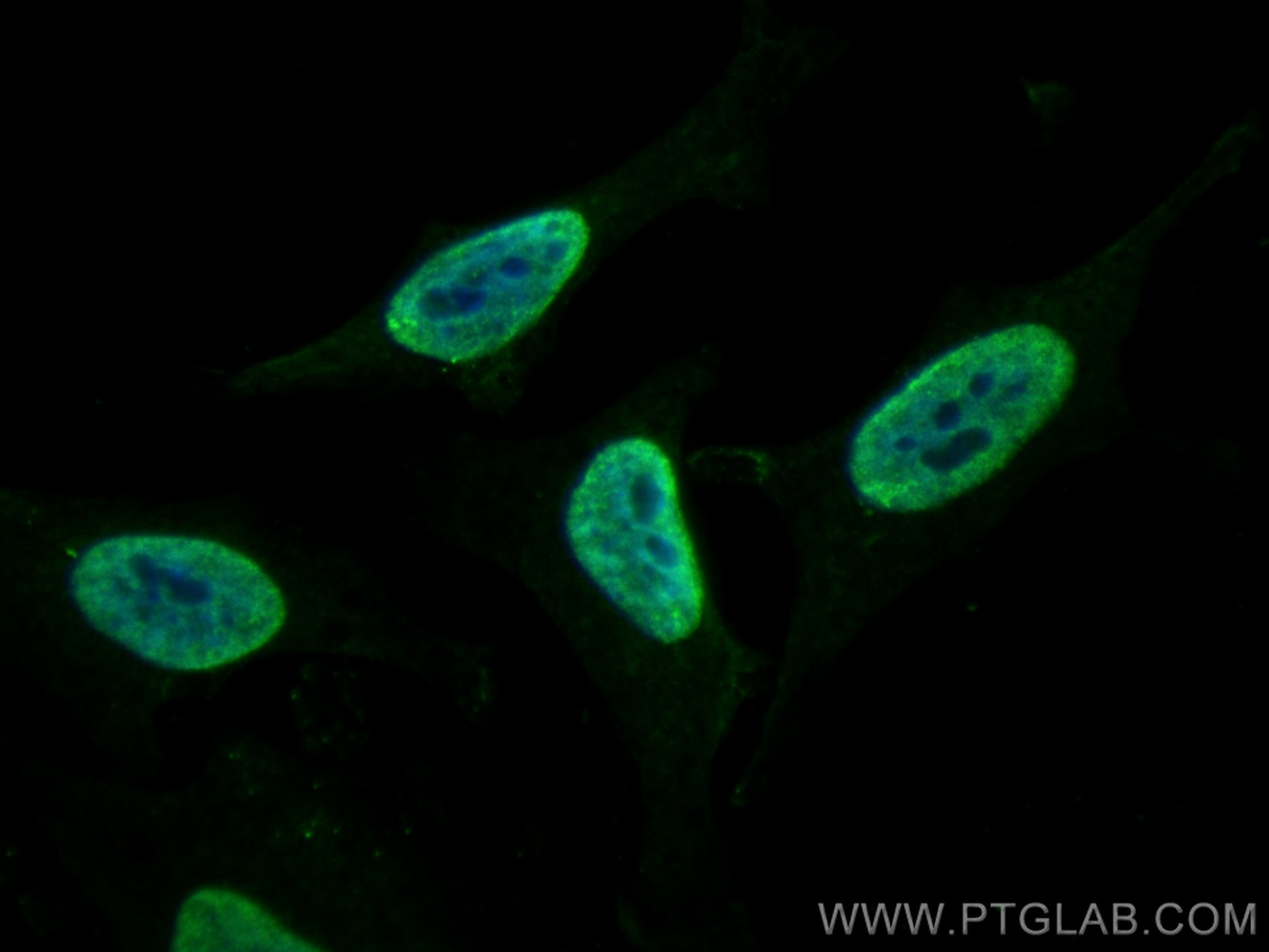 Immunofluorescence (IF) / fluorescent staining of HeLa cells using SFPQ Monoclonal antibody (67129-1-Ig)