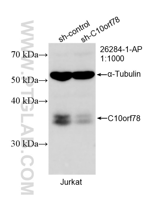 WB result of C10orf78 antibody (26284-1-AP; 1:1000; incubated at room temperature for 1.5 hours) with sh-Control and sh-C10orf78 transfected Jurkat cells. Western Blot (WB) analysis of Jurkat cells using SFR1 Polyclonal antibody (26284-1-AP)