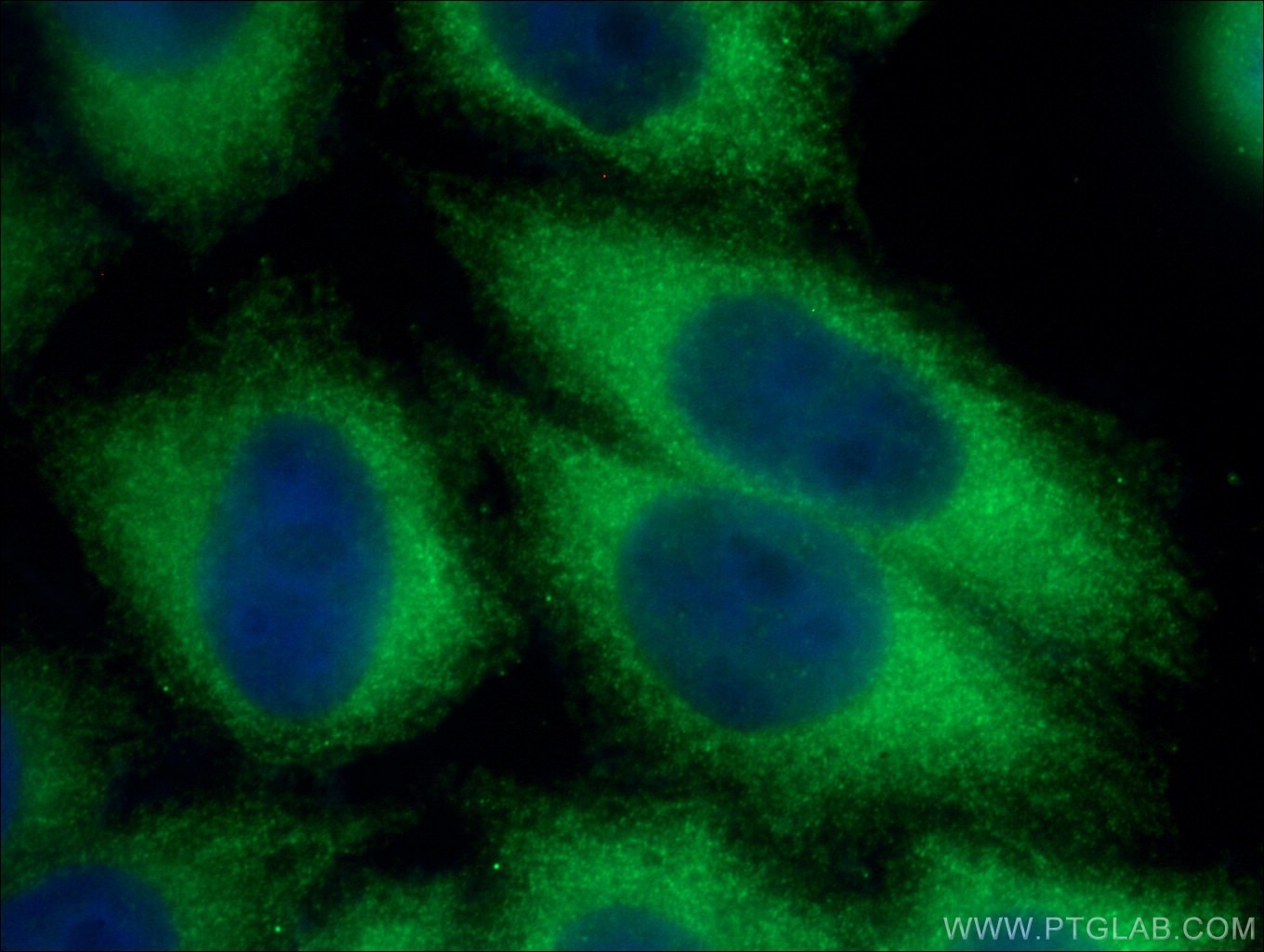 Immunofluorescence (IF) / fluorescent staining of HeLa cells using SFRP1 Polyclonal antibody (26460-1-AP)