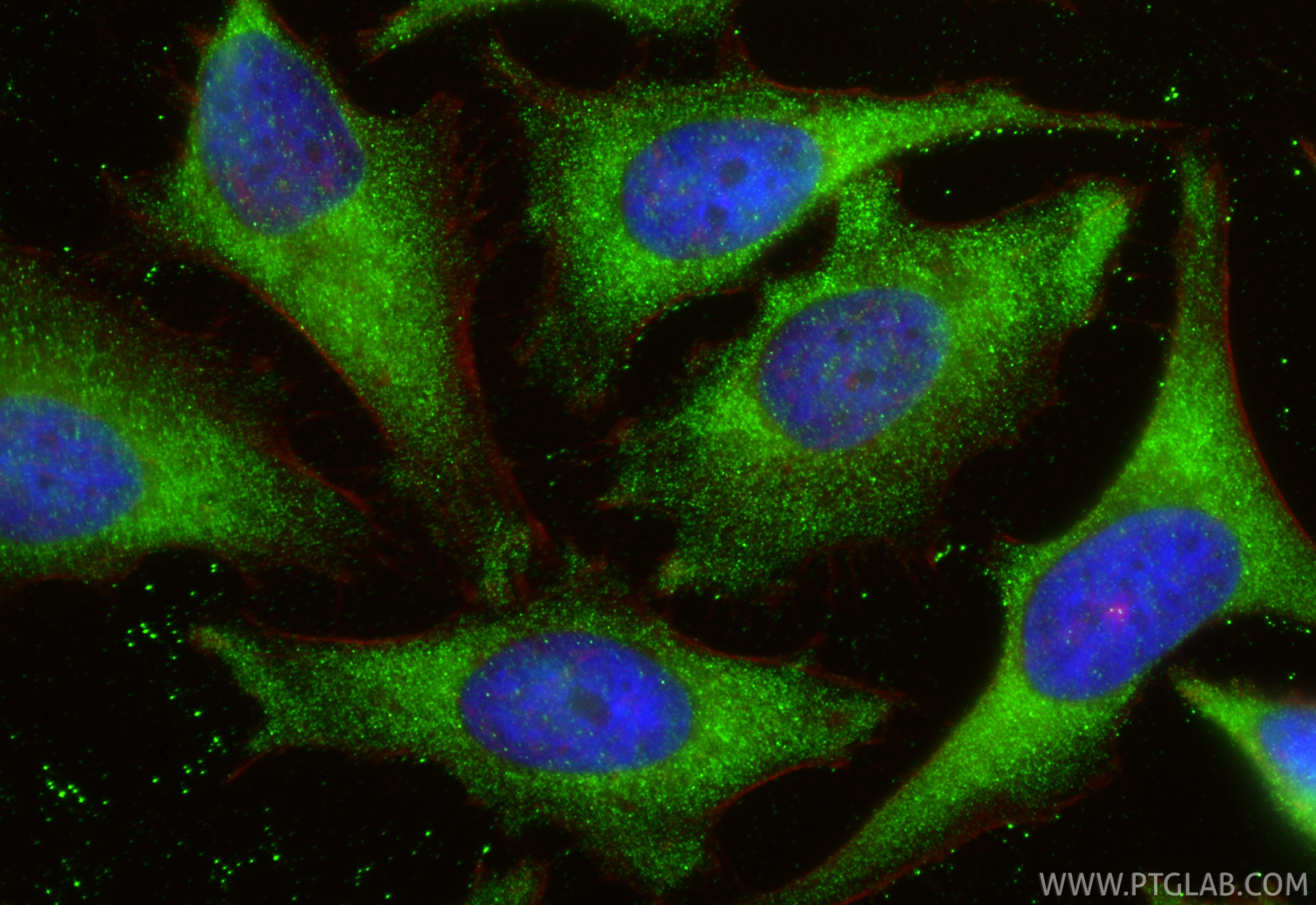 Immunofluorescence (IF) / fluorescent staining of HeLa cells using SFRP1 Polyclonal antibody (26460-1-AP)