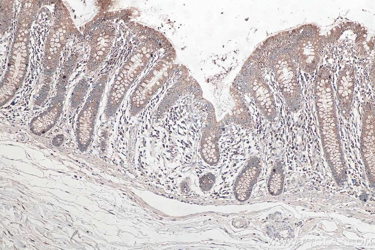 Immunohistochemistry (IHC) staining of human colon tissue using SFRP1 Polyclonal antibody (26460-1-AP)