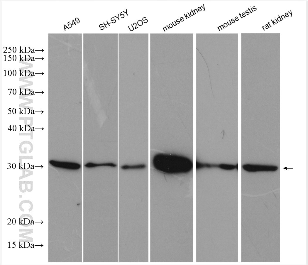 Western Blot (WB) analysis of various lysates using SFRP1 Polyclonal antibody (26460-1-AP)