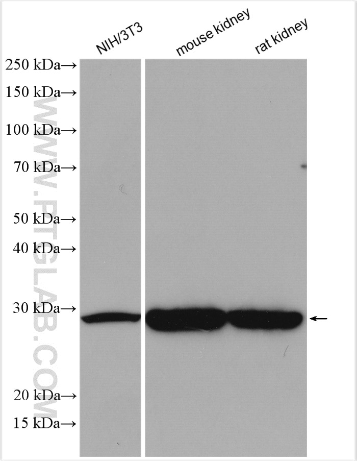 Western Blot (WB) analysis of various lysates using SFRP1 Polyclonal antibody (26460-1-AP)