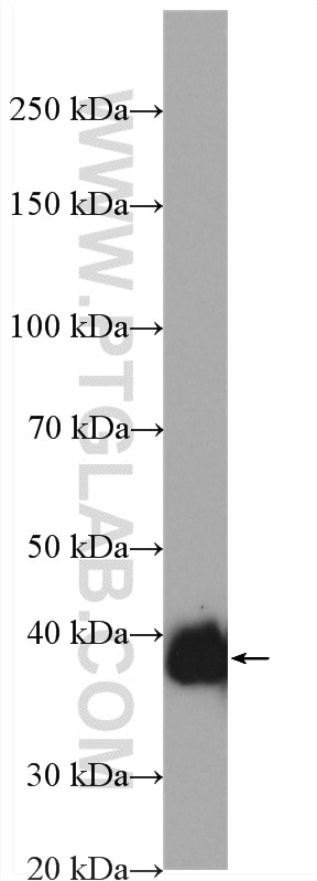 Western Blot (WB) analysis of human testis tissue using SFRP1 Polyclonal antibody (28271-1-AP)