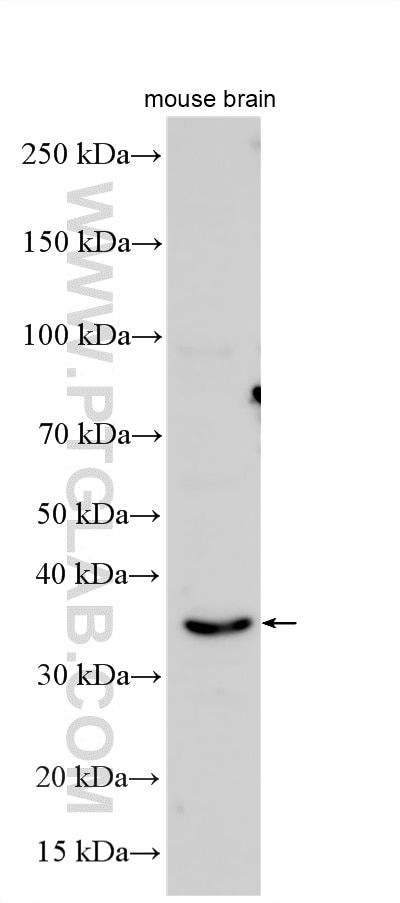 WB analysis using 12189-1-AP Western Blot (WB) analysis of various lysates using SFRP2 Polyclonal antibody (12189-1-AP)