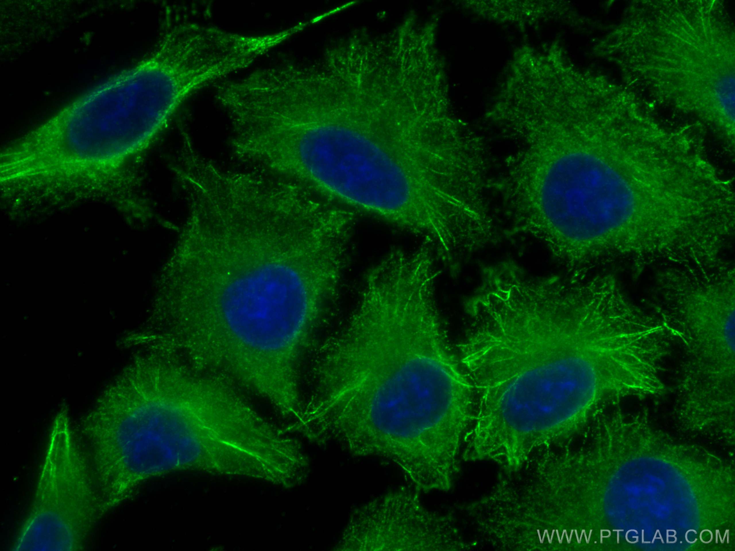 Immunofluorescence (IF) / fluorescent staining of A549 cells using SFRP2 Monoclonal antibody (66328-1-Ig)