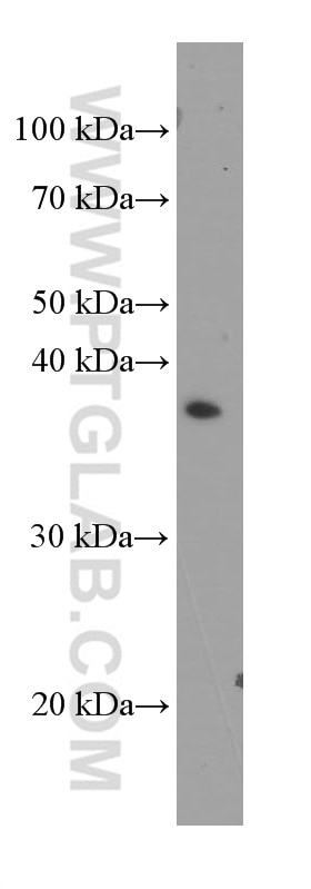 Western Blot (WB) analysis of Y79 cells using SFRP2 Monoclonal antibody (66328-1-Ig)