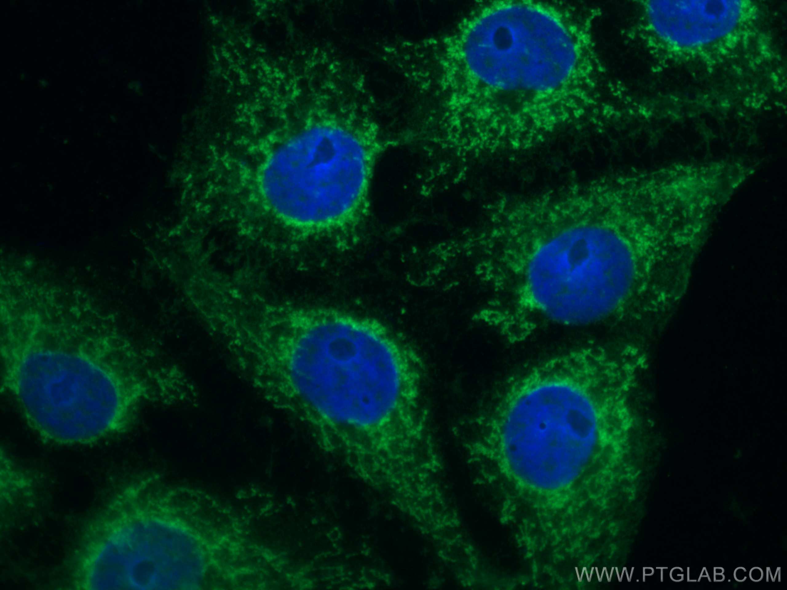 Immunofluorescence (IF) / fluorescent staining of SH-SY5Y cells using CoraLite® Plus 488-conjugated SFRP2 Monoclonal ant (CL488-66328)