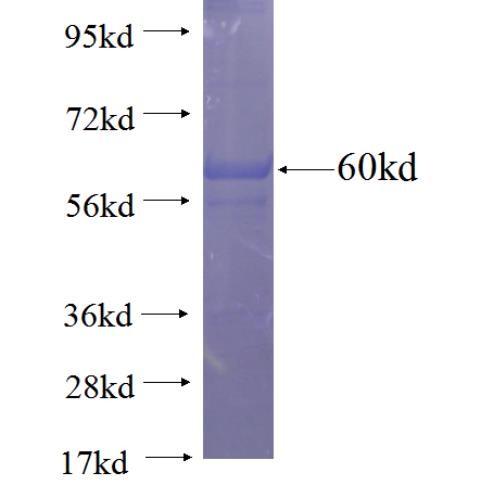 SFRP2 fusion protein Ag2853 SDS-PAGE